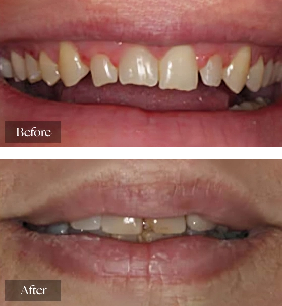 Smile Transformations